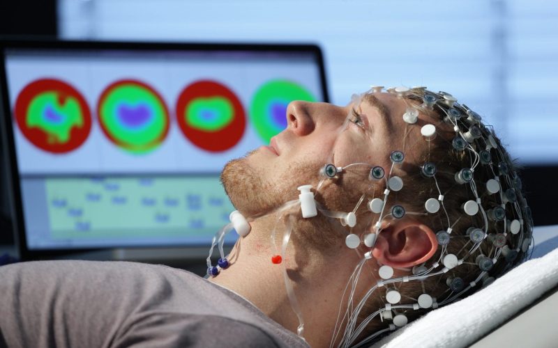 eletroencefalograma-e1514416021114